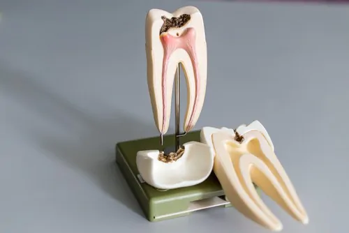 model of root canal