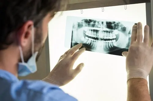 man examines dental x-ray