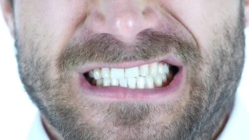 man grinds teeth